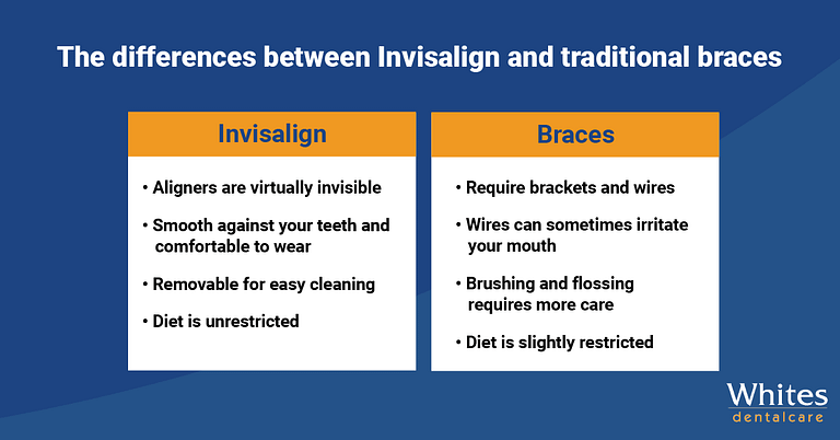 The differences between Invisalign and traditional braces